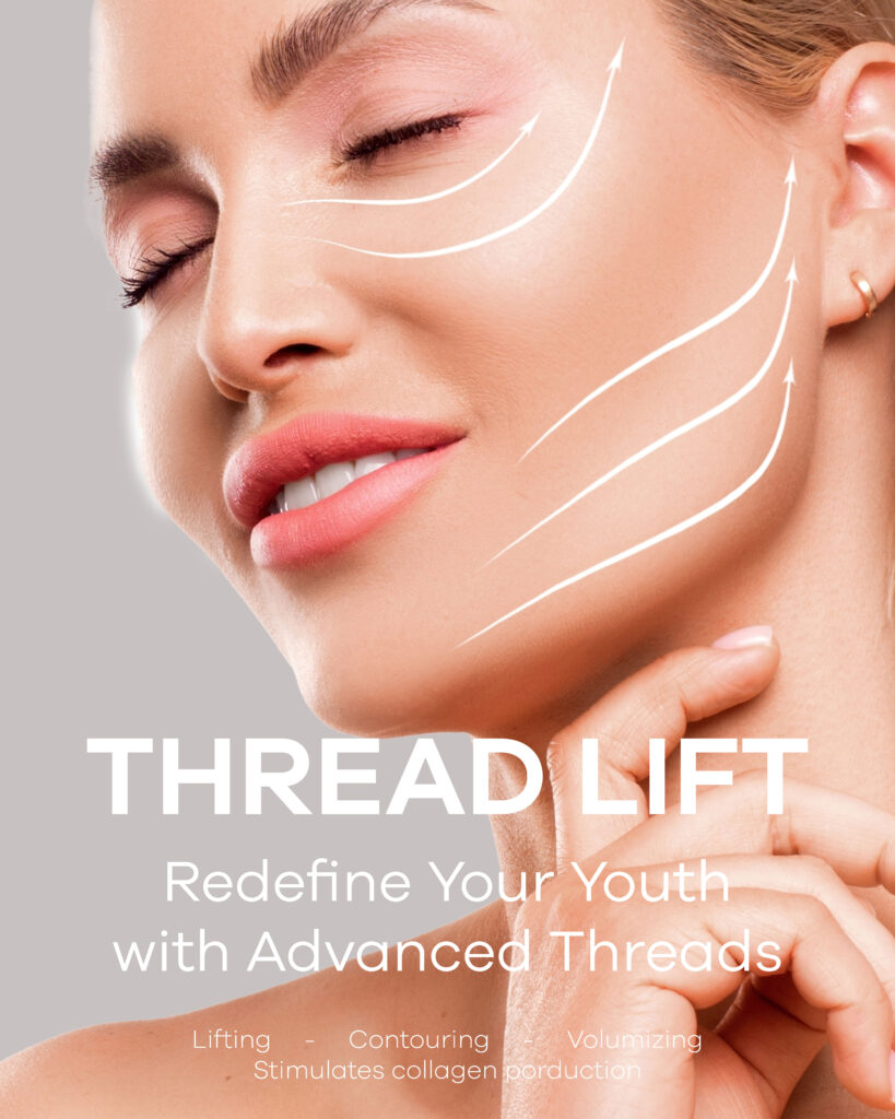 Thread Lift